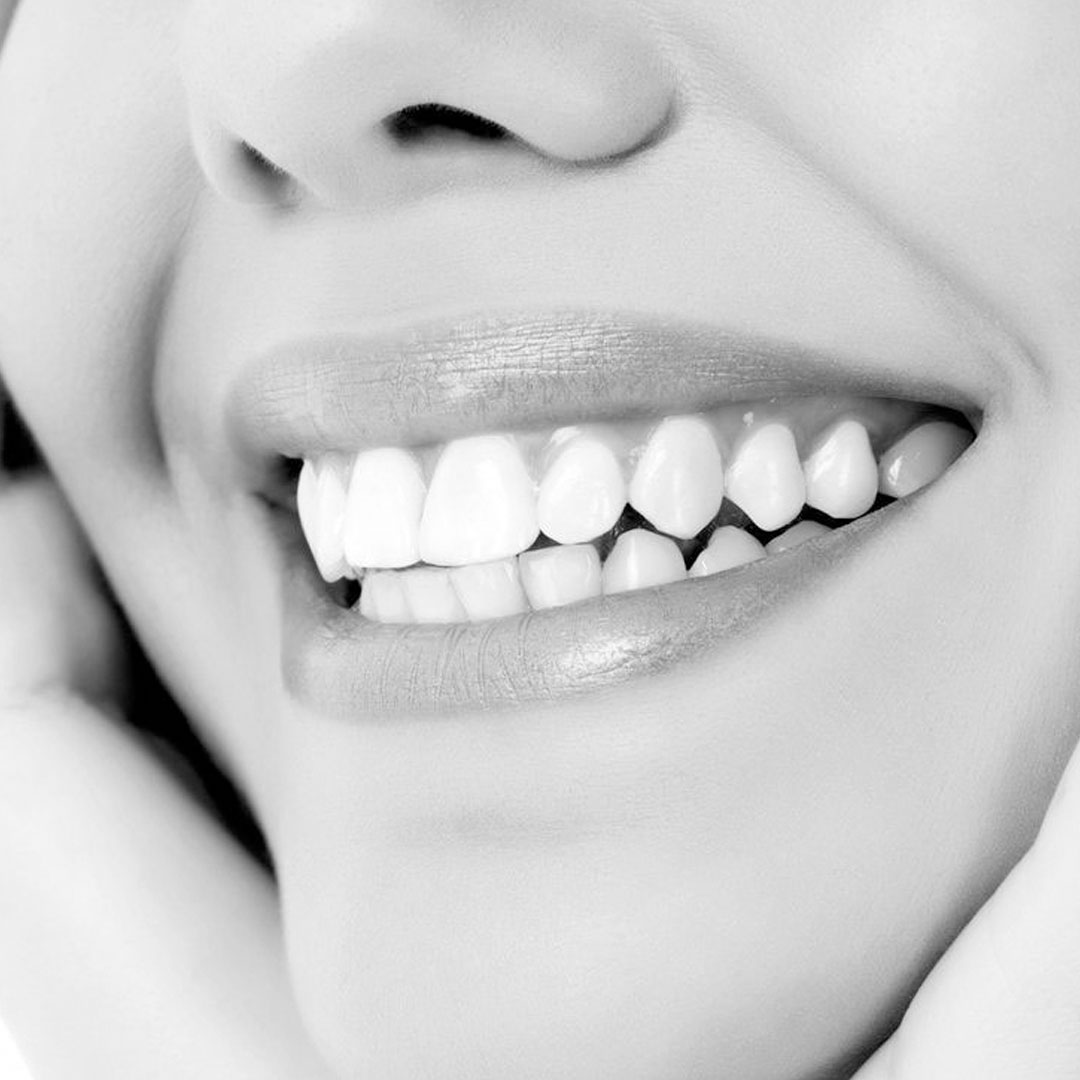 Metal-Ceramic, Zirconia, and E-Max Crowns