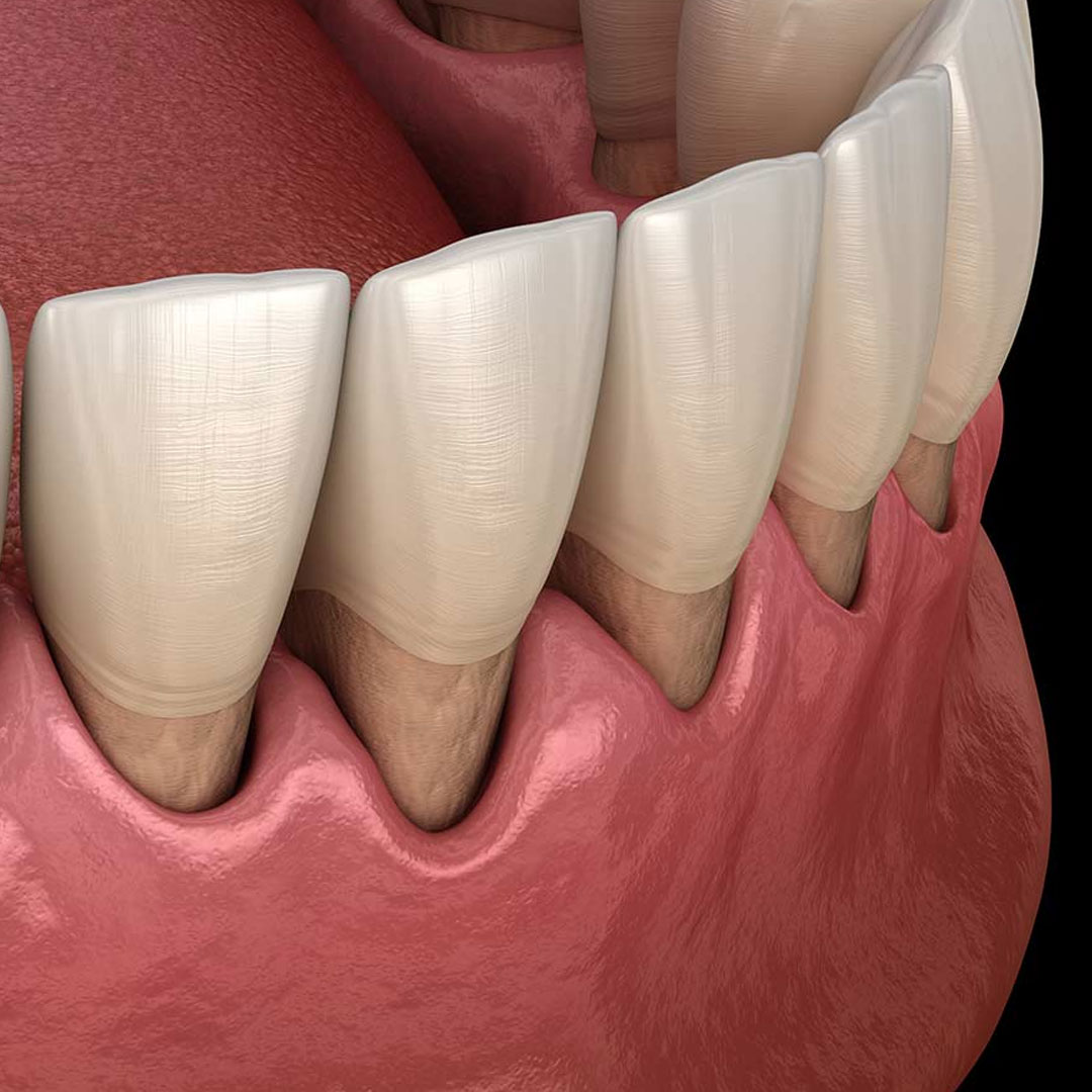 What Is the Periodontology/Gum Diseases Department?