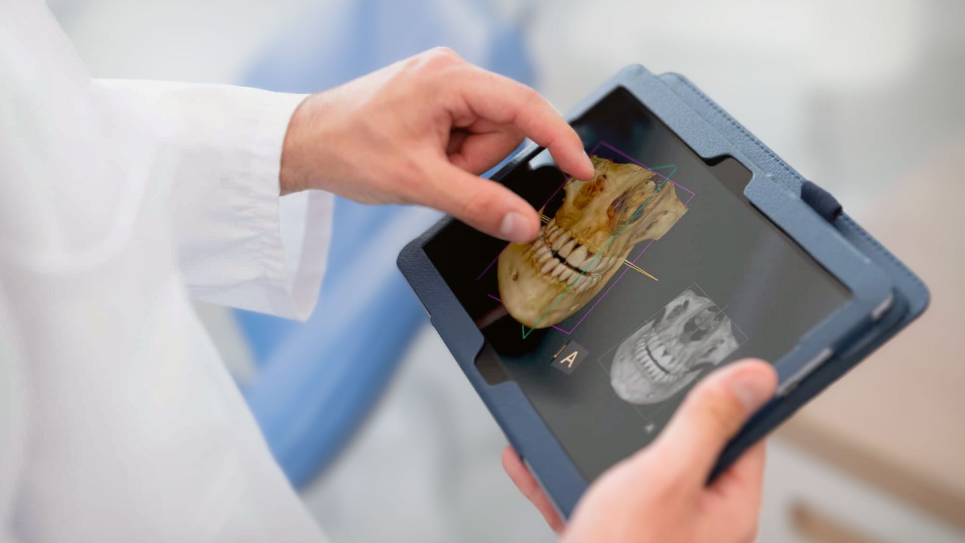 Dental Tomografi / Radyoloji