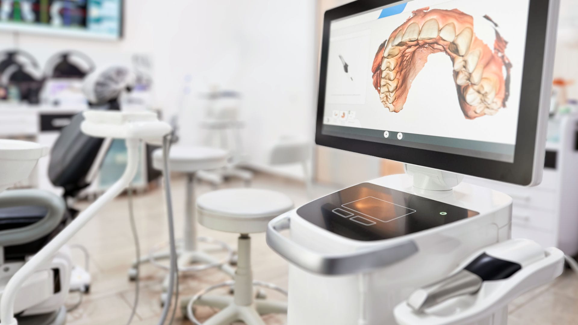 Dijital İmplantoloji