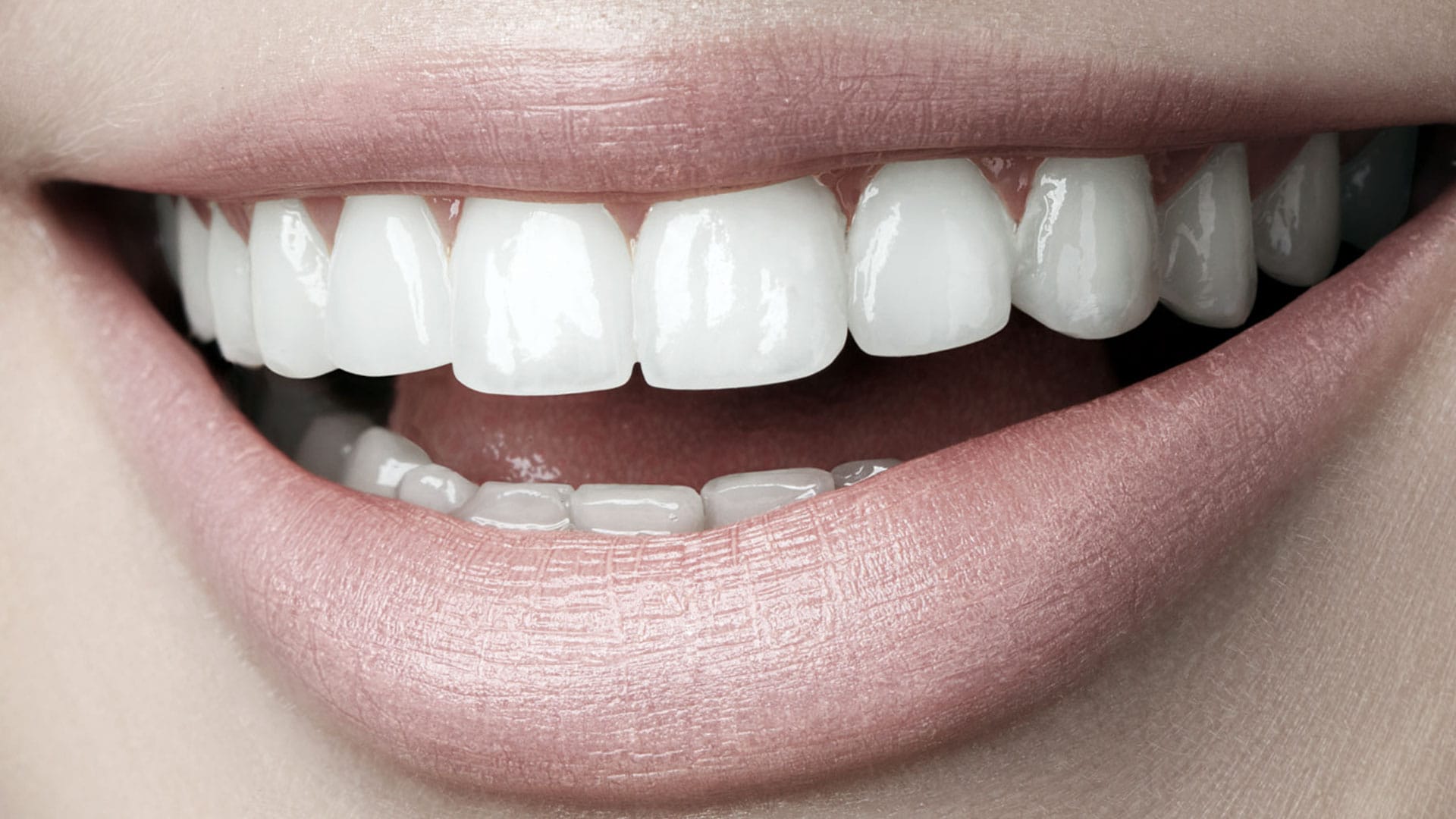 Hollywood Smile