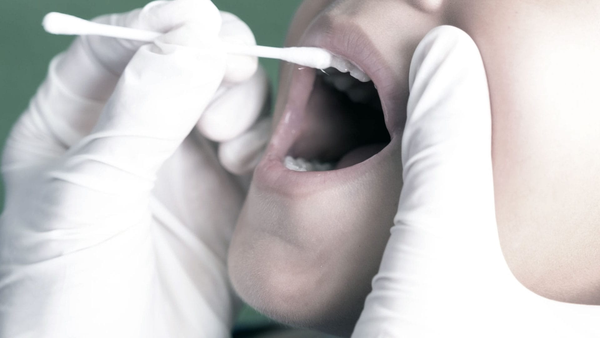 Koruyucu Uygulamalar