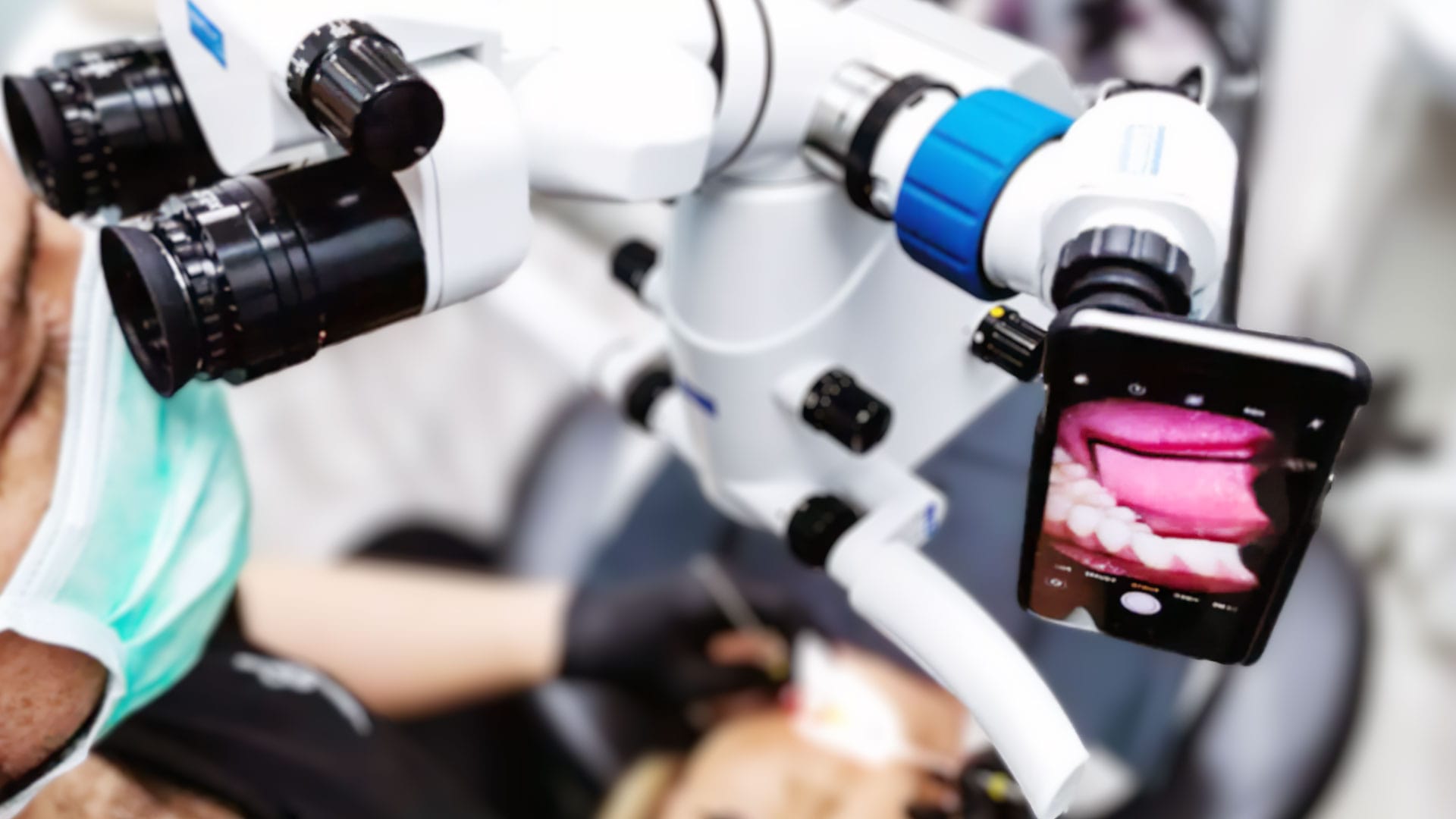 Mikroskop Destekli Diş Eti Tedavisi